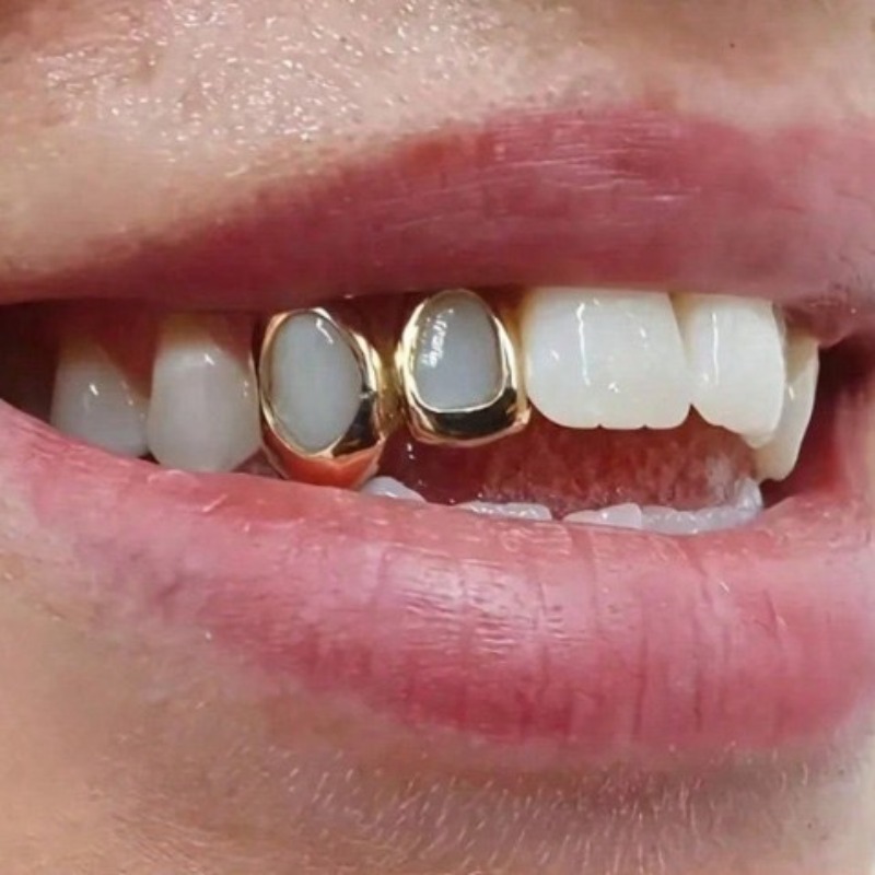 Goldene Grillz Zahnschmuck-Set – Body Jewelry Changing Kit Bewertung und Preis